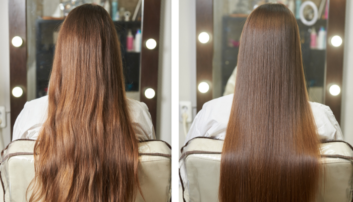 Capillus Botox Capilar zabieg przed & po